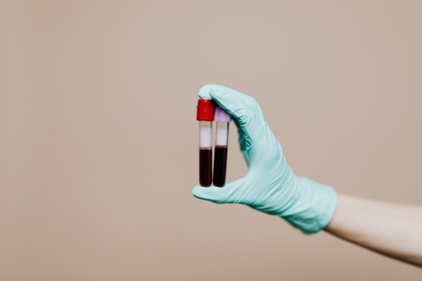 ¿Que es el Carrier Screening?