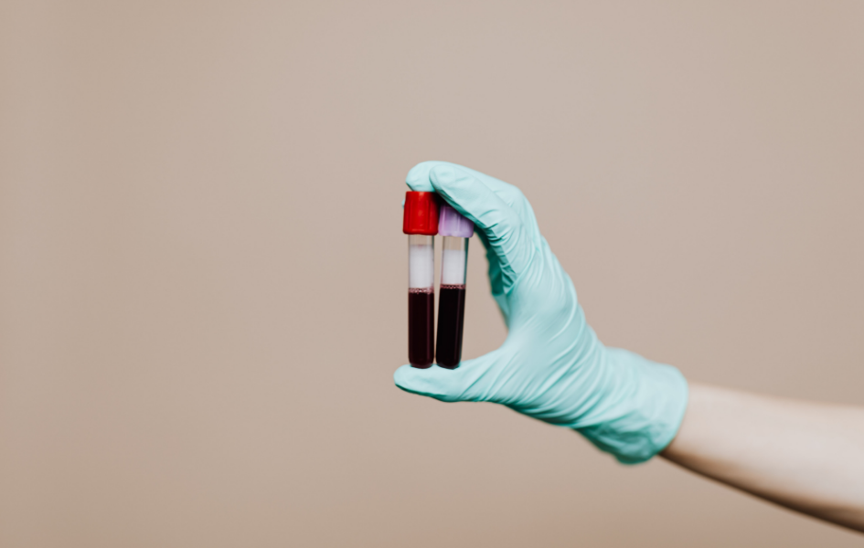 ¿Que es el Carrier Screening?